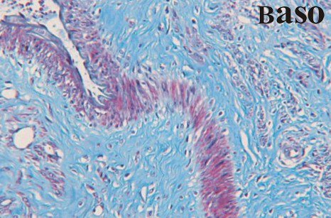 Massons Trichrome Stain