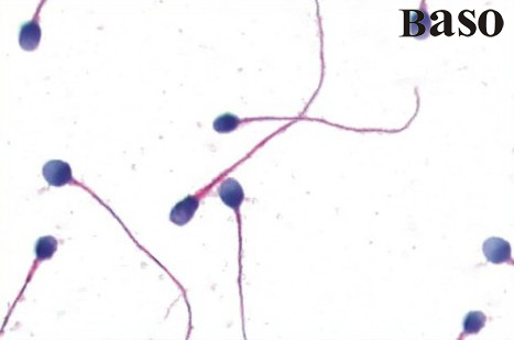 精子(细胞)形态学染色液（标准巴氏法）